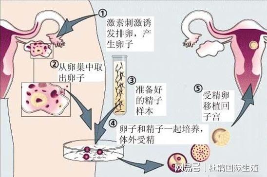 供卵去哪里做比较好【供卵去哪里做比较好?选择最佳供卵地点的指南】