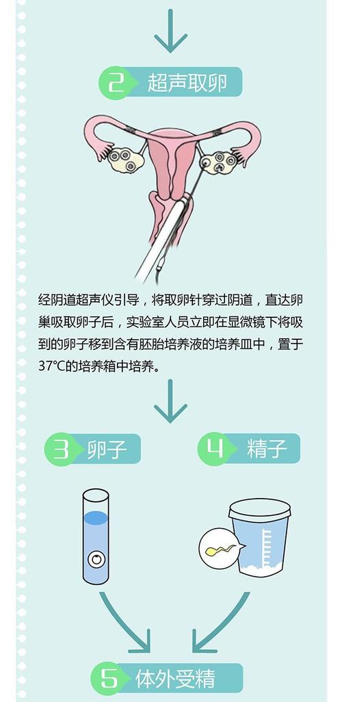 供卵试管代怀双胞胎流程_供卵试管代怀双胞胎流程详解